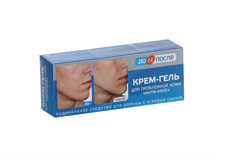 Крем-гель д/промблем кожи анти-акне до и после, 50 мл